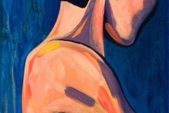 Sunburn